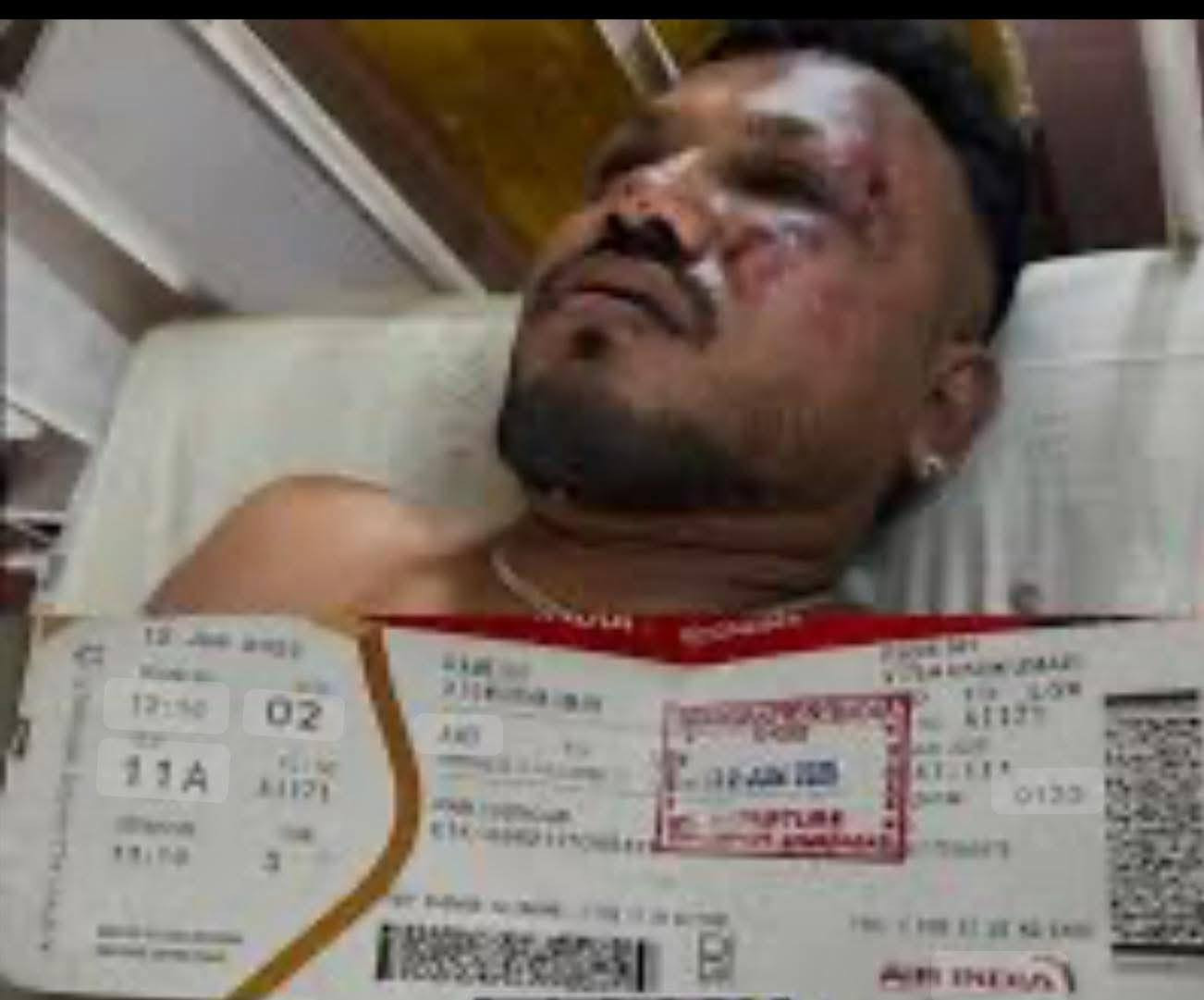 एयर इन्डिया जहाज दुर्घटनाः २४२ मध्य ‘काल’लाई जितेर फर्किएका रमेशले के–के देखेछन्?